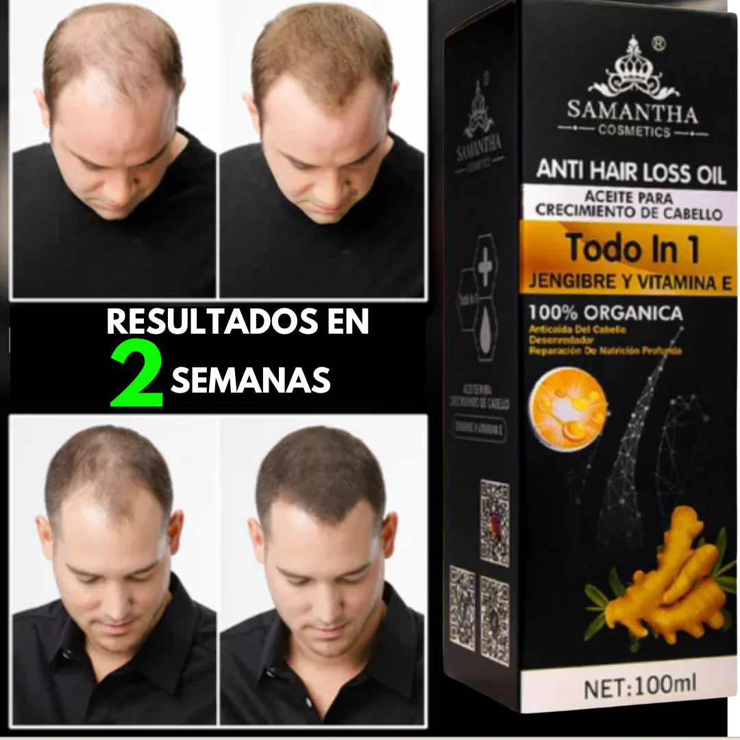 ACEITE PARA CRECIMIENTO DEL CABELLO
